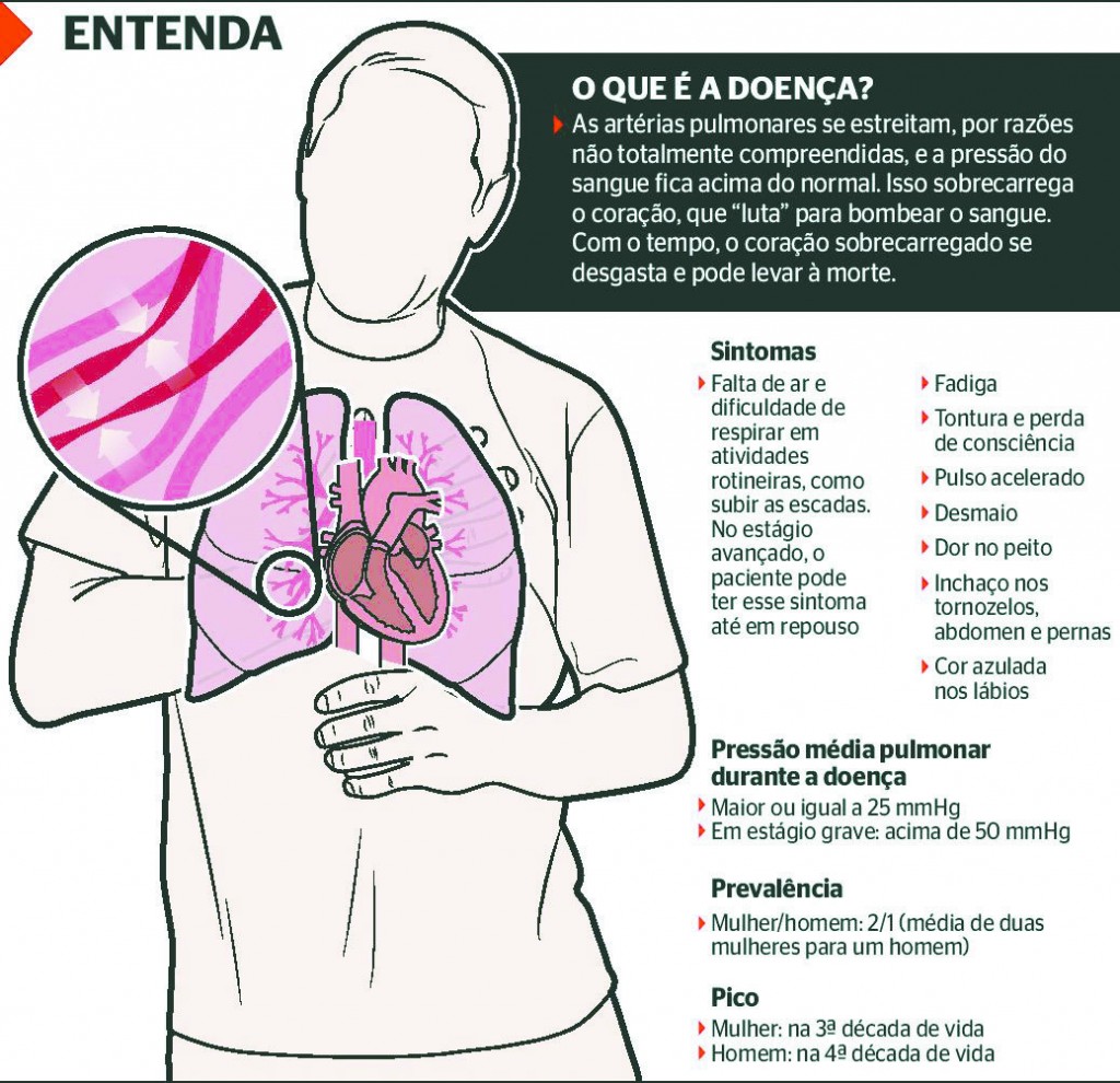 16 - Hipertensão pulmonar